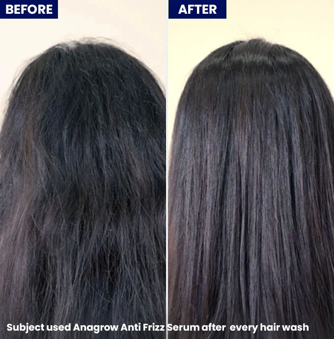 Anagrow Anti Frizz Hair Serum - Image 4