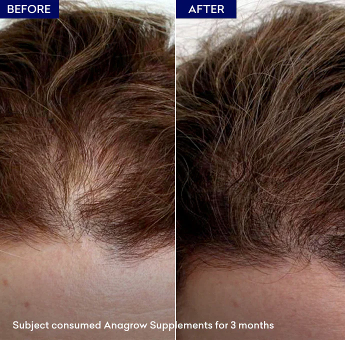 Anagrow Soft Gel Capsules - Image 4