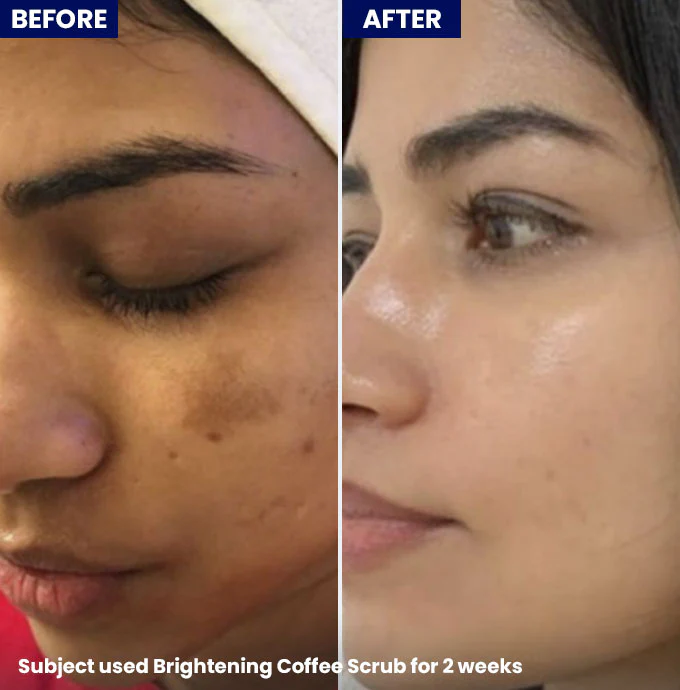 Brightening Coffee Scrub - Image 5