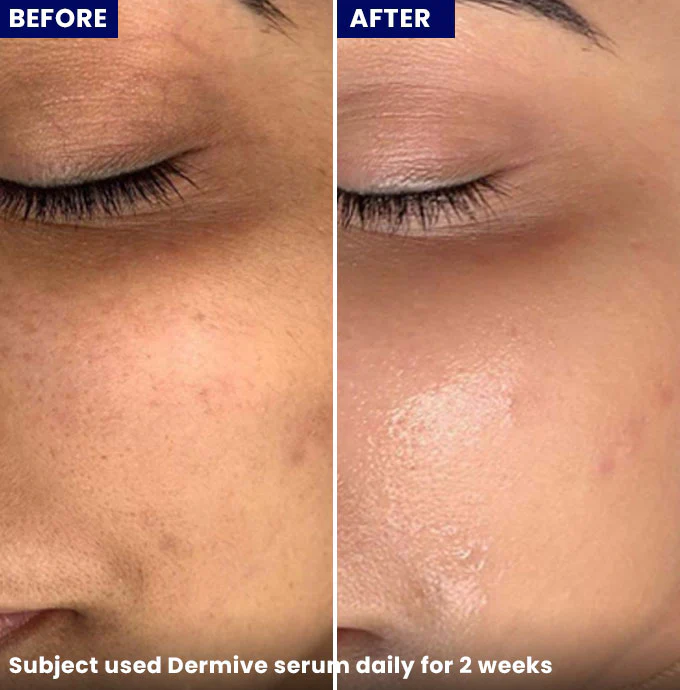 Dermive Hydrating Serum - Image 4