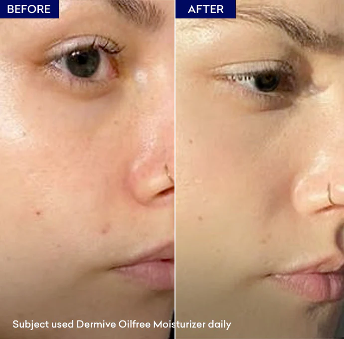 Dermive Oil Free Moisturizer - Image 5