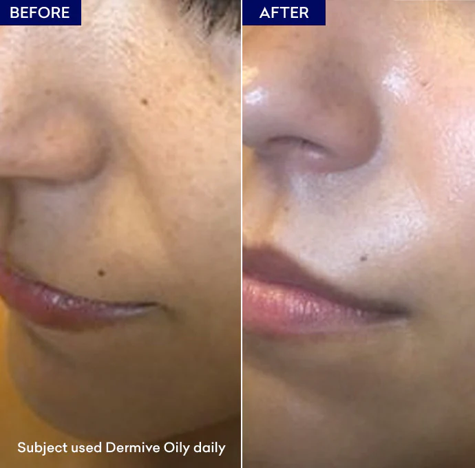 Dermive Oily - Image 5