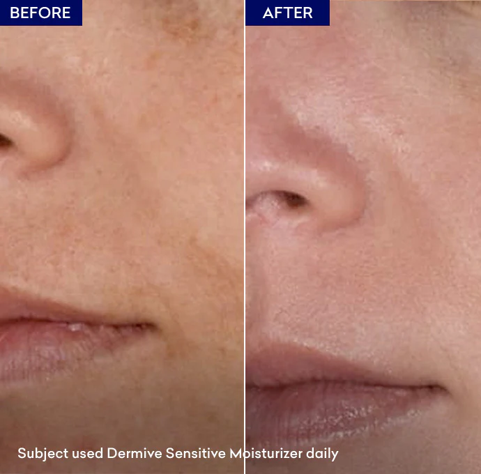 Dermive Sensitive Moisturizer - Image 4