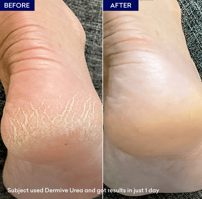 Dermive Urea - Image 4