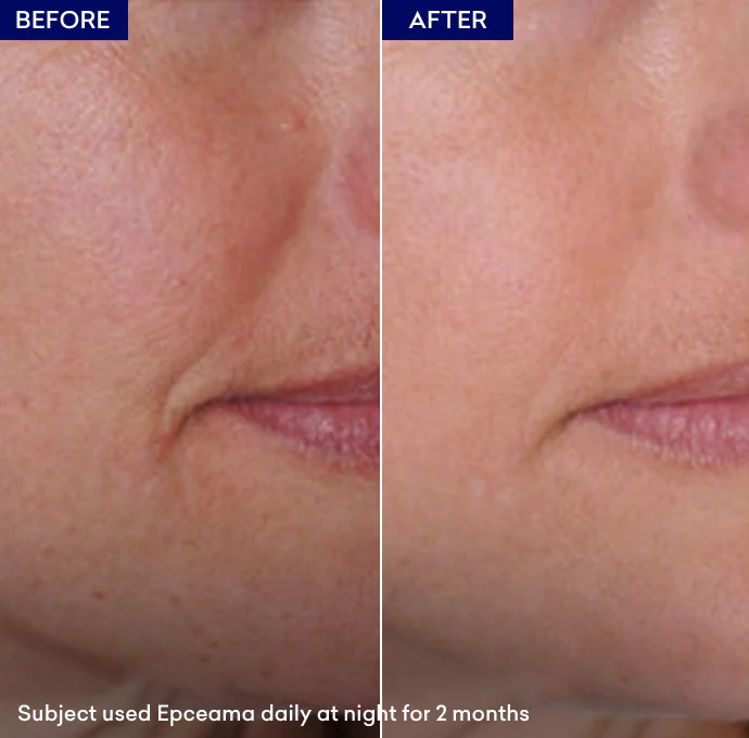 Epceama Anti Aging Serum - Image 4