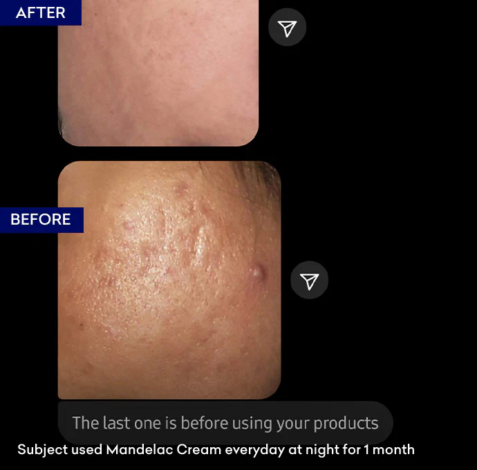 MandelAC Cream - Image 4