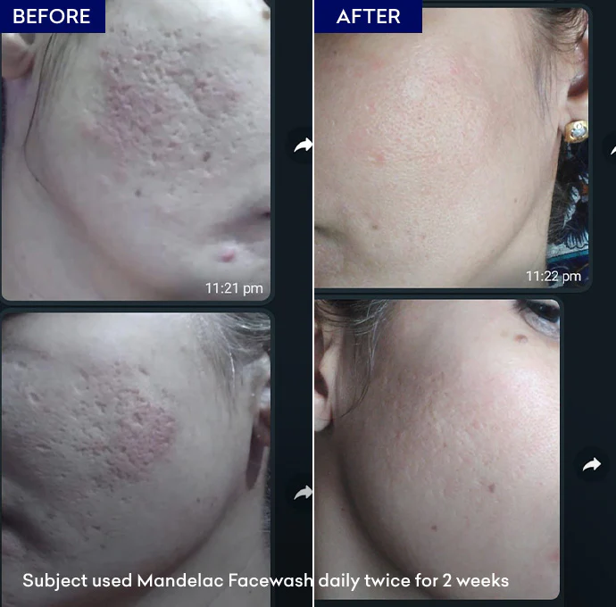 MandelAC Facewash - Image 5