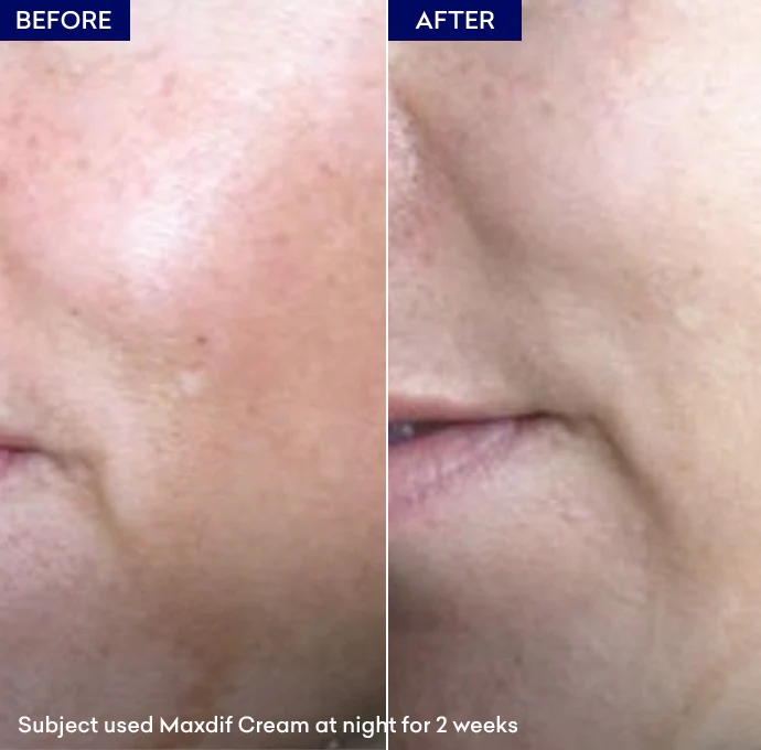 Maxdif Brightening Cream - Image 4