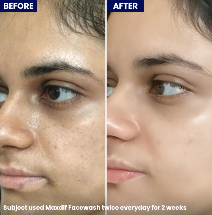 Maxdif Facewash - Image 4