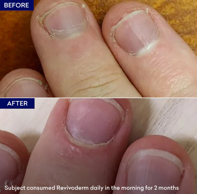 Revivoderm - Image 4