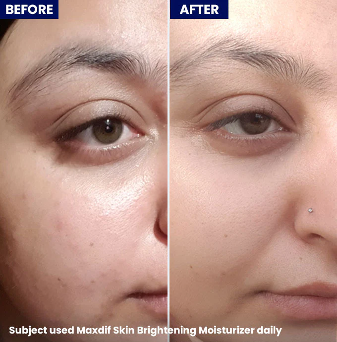 Maxdif Brightening Moisturizer - Image 5