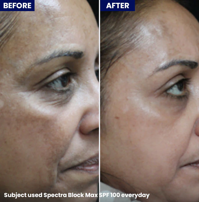 Spectra Block Max 100 - Image 4