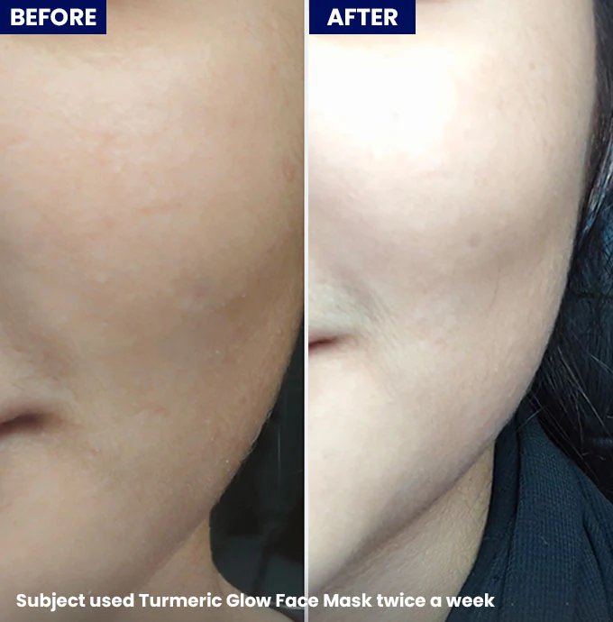 Turmeric Glow Face Mask - Image 8